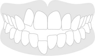 Resalte
