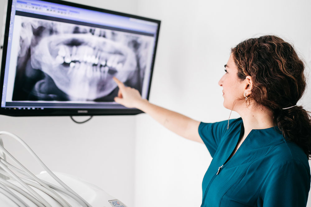 Implantes dentales en Heferclinic