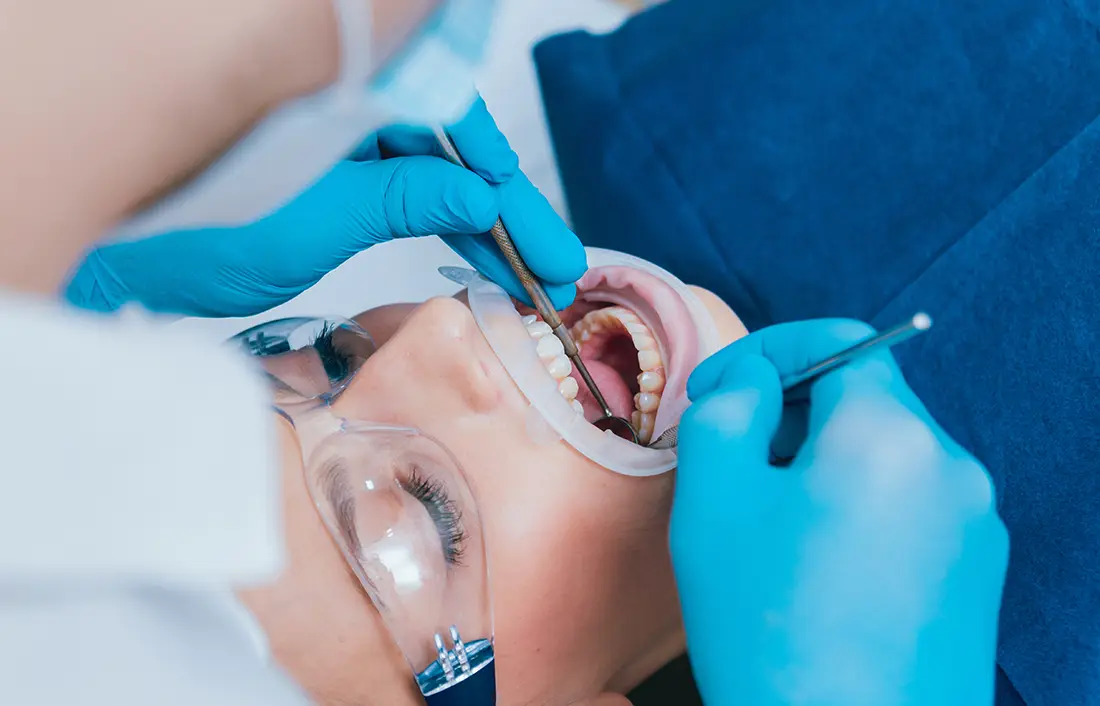 Tratamiento de endodoncia