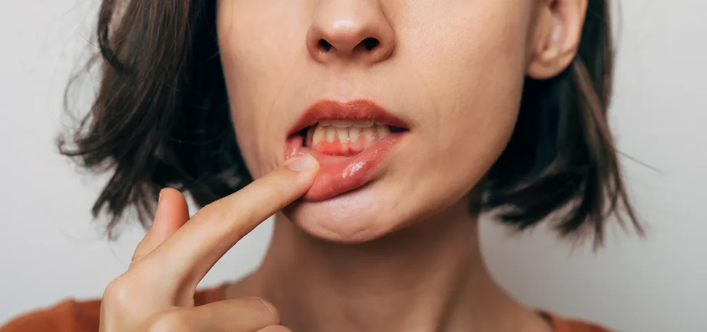 Problemas periodontales