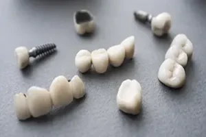 Prótesis implantes
