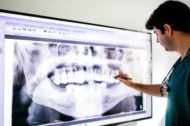 Tratamiento endodoncia