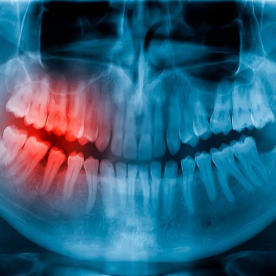 cirugia-maxilofacial