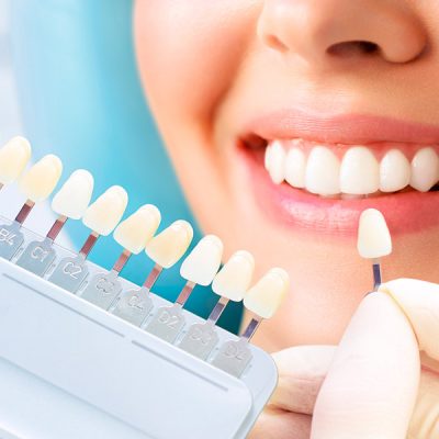 estetica-dental estetica-dental