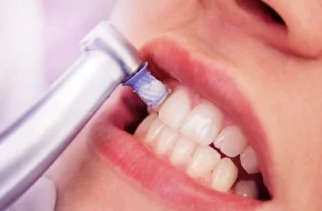 limpiezas periodontales profesionales