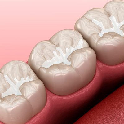 odontologia-restauradora odontologia-restauradora